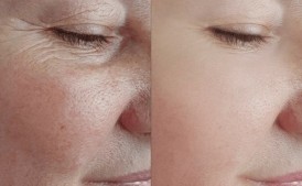 Gold Revive - krem na zmarszczki